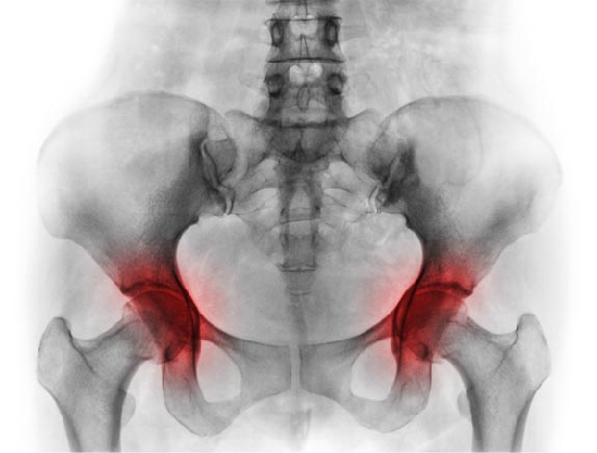 Hip Flexors 1